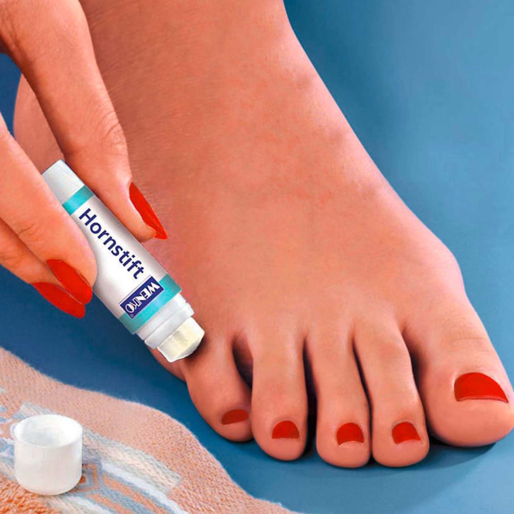 Anwendung des Hornhautsifts